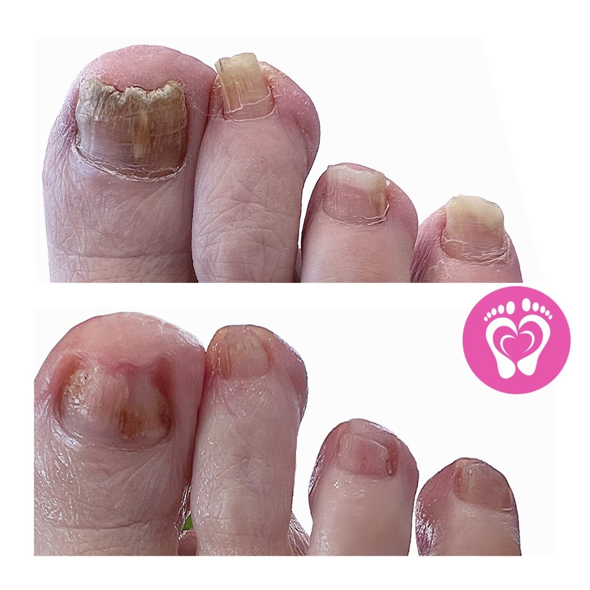 Advanced Foot Health Clinic