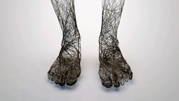 Amit Bhargava London – Orthopaedic Specialist Foot Ankle BOFAS Surgeon Private Clinic Injury Centre