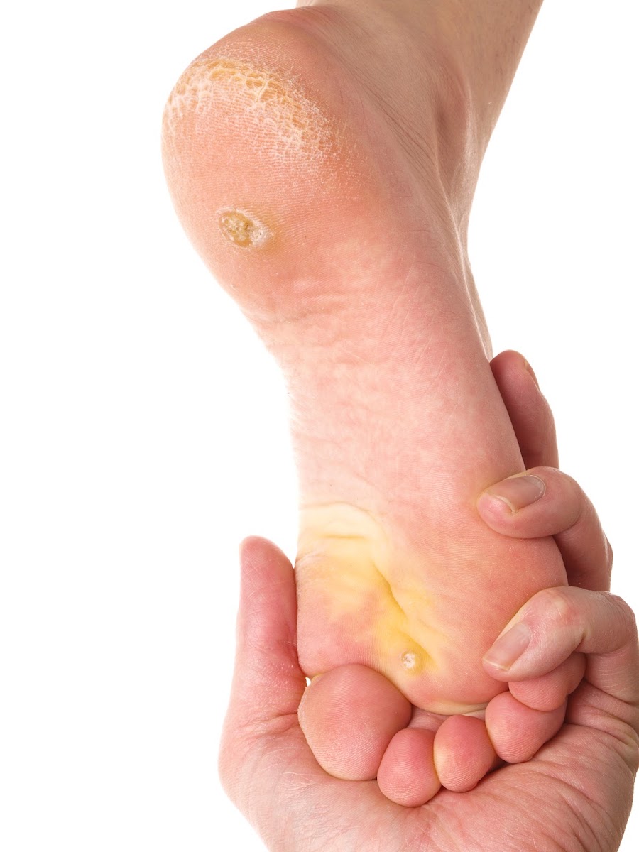 Chelmer Footcare