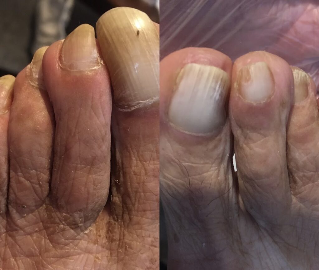 Crystal Foot Care