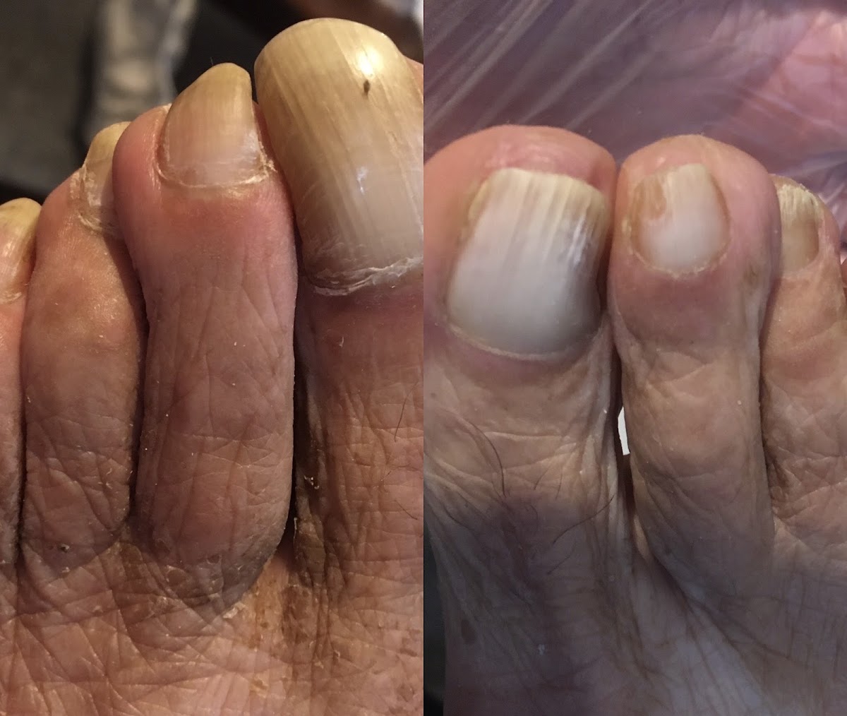 Crystal Foot Care
