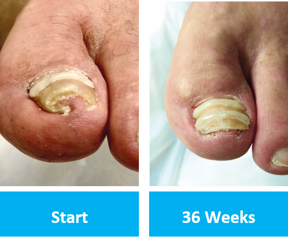 Easy Feet Podiatry