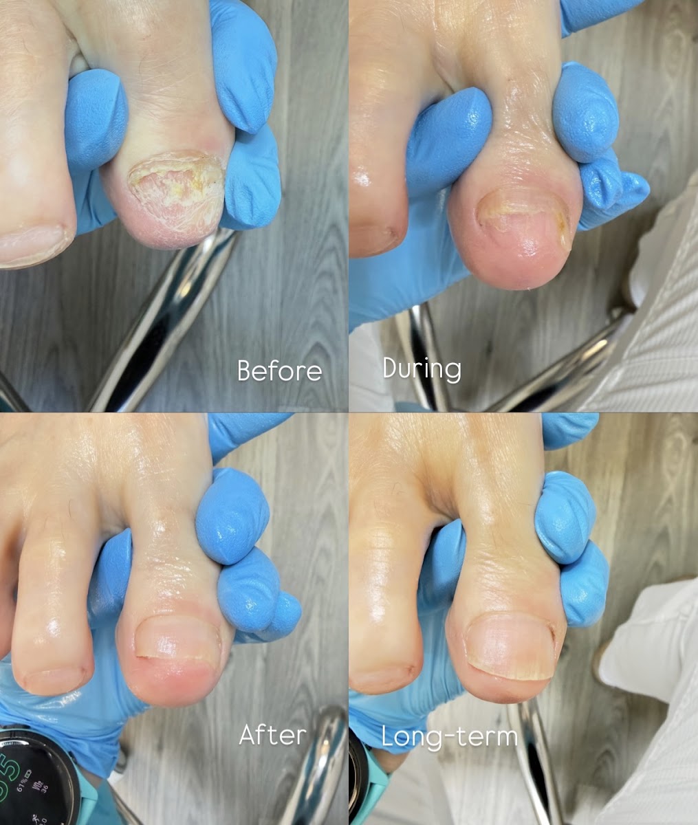 Foot Saver