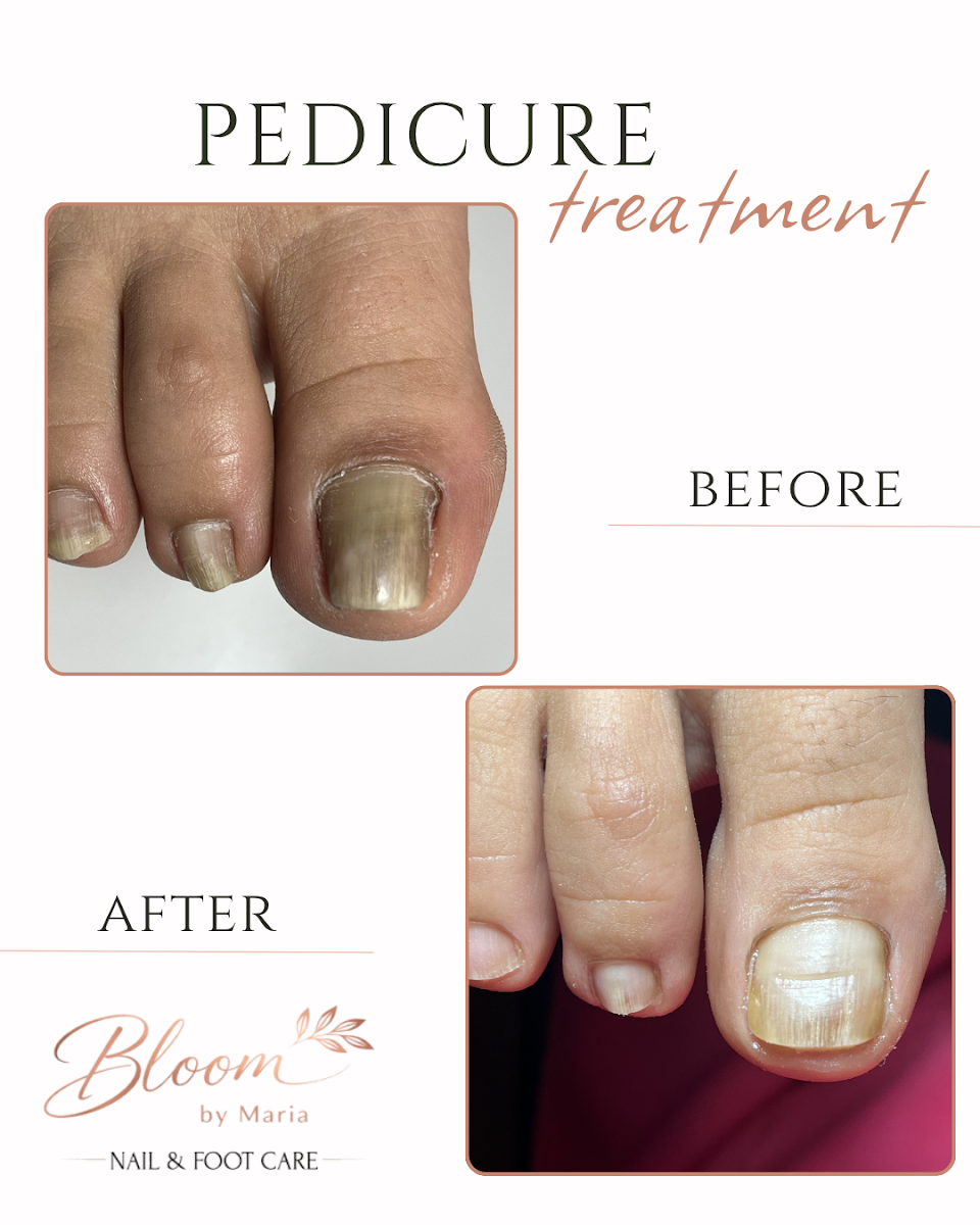 Maria D | Nail Foot Care