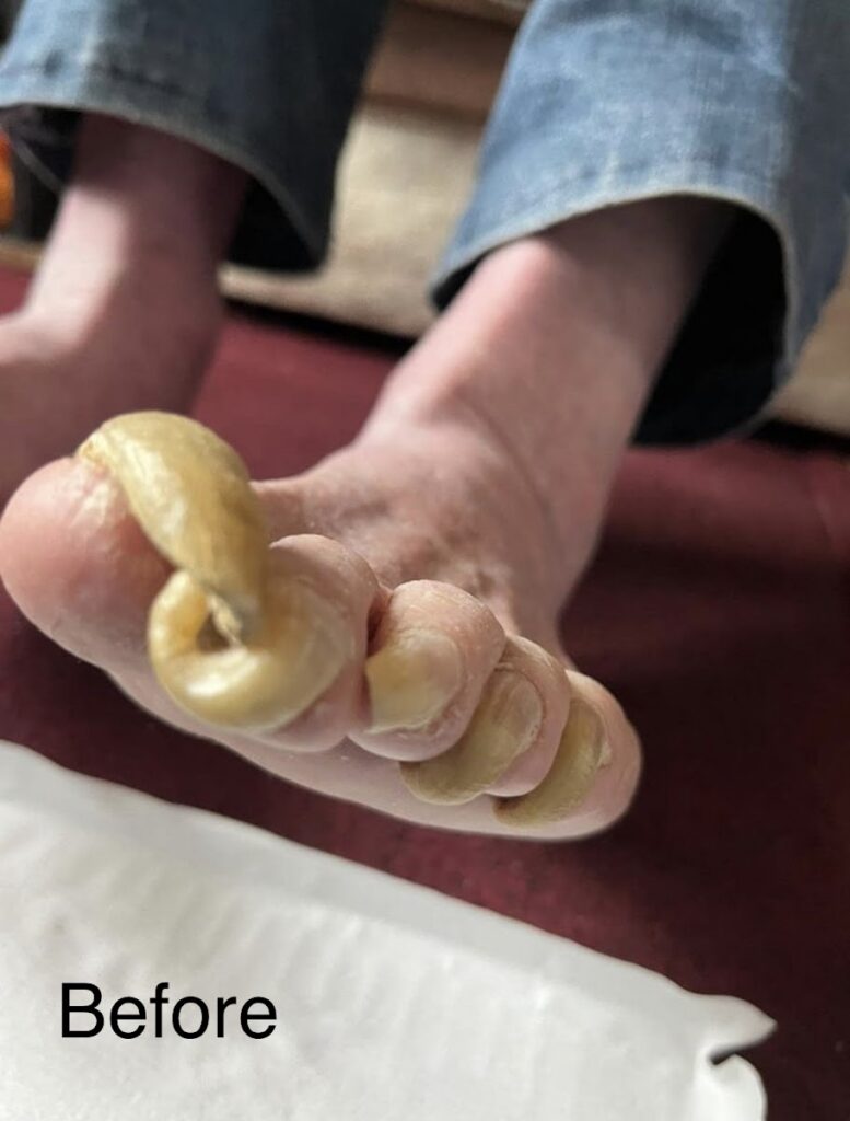 Mend Your Feet