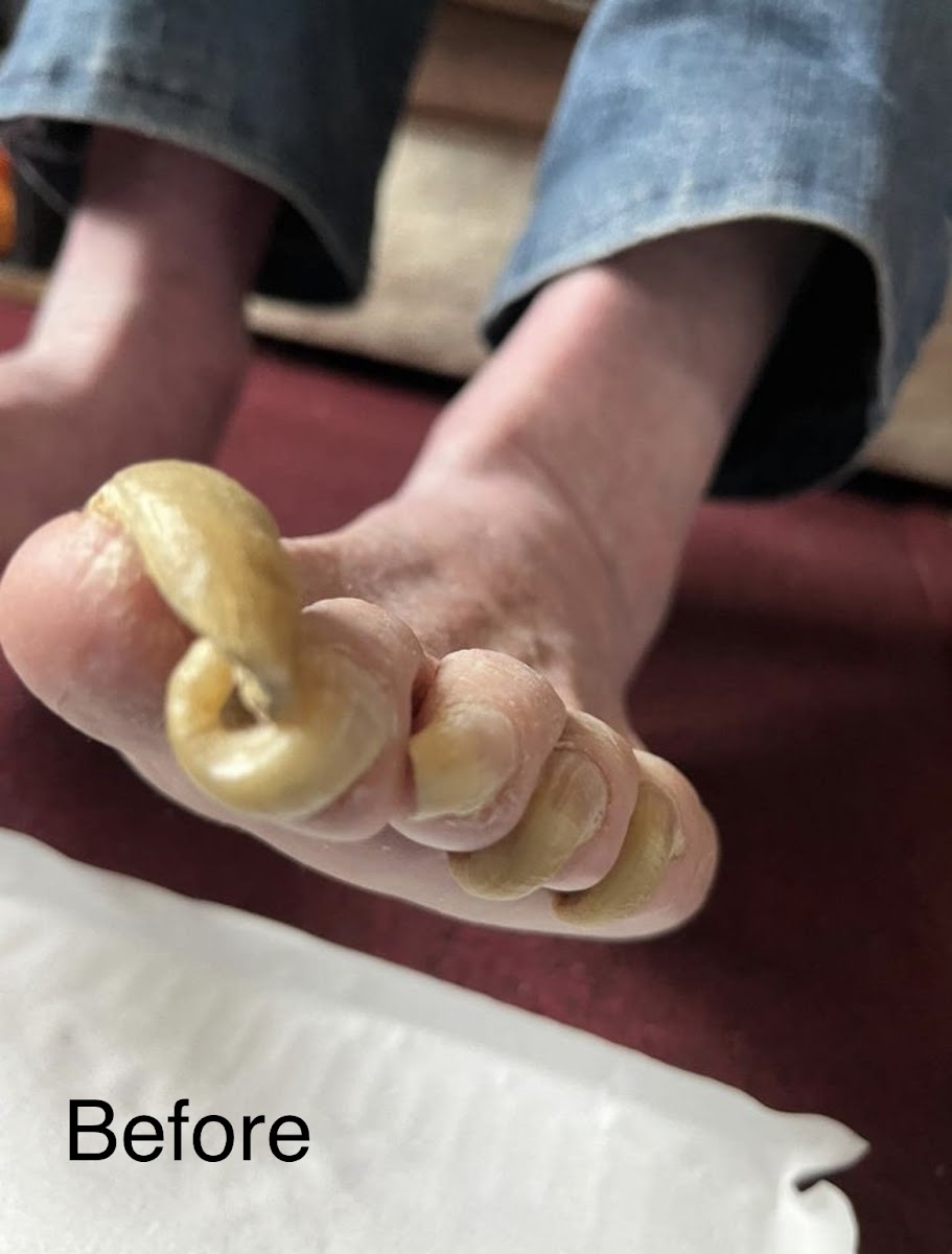 Mend Your Feet