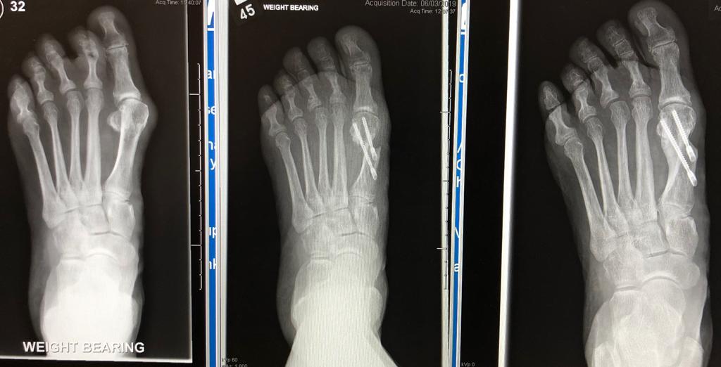 Sussex Foot & Ankle Clinic