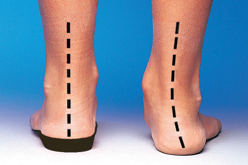 Writtle Podiatry Practice Hellen Brown and Paula Reid