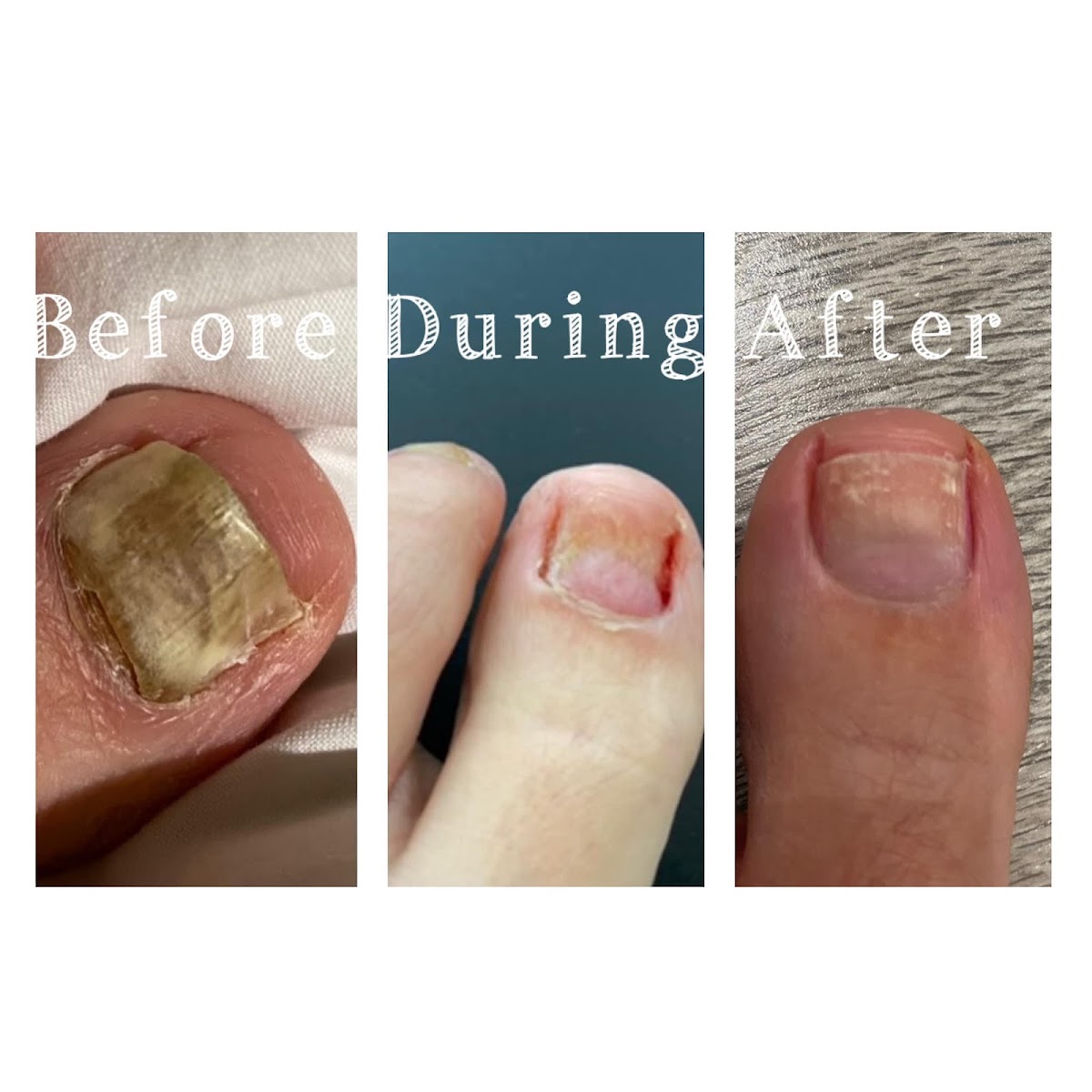 Claire skinner foot therapy