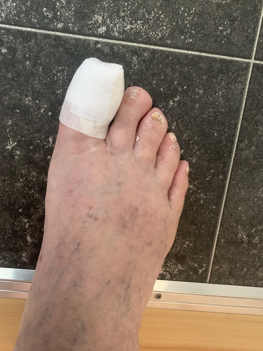 Exmouth Podiatry by Two Right Feet