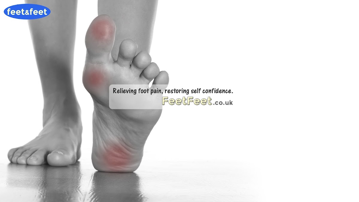 Feet&Feet