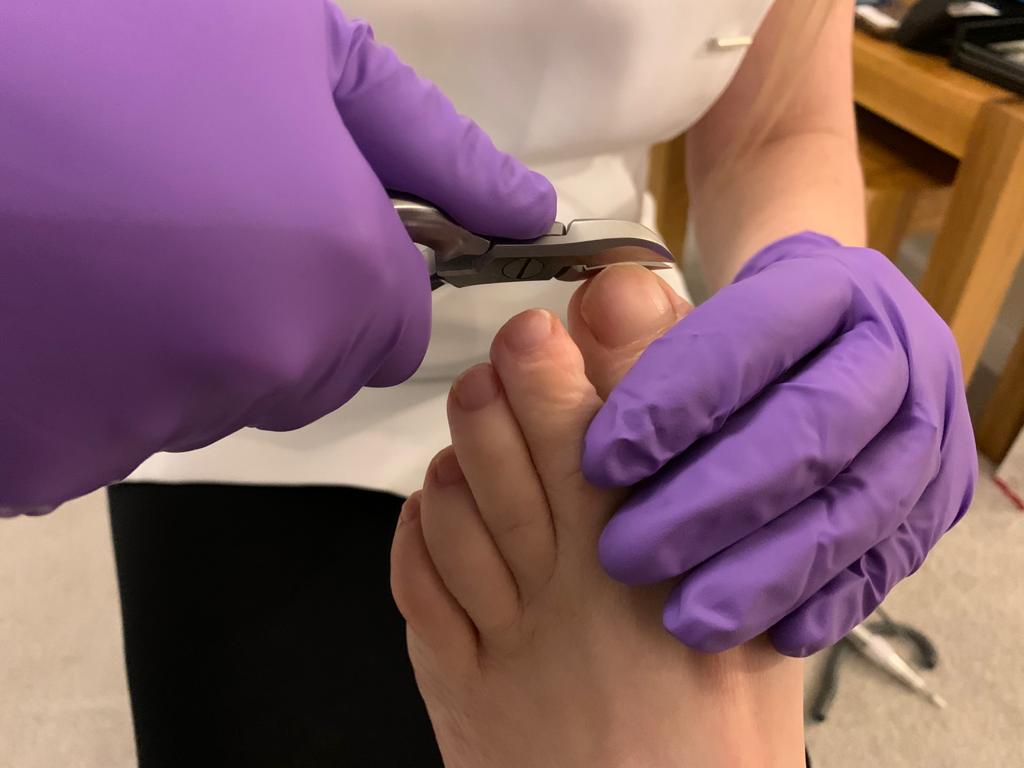 Newman’s Foot Health – Foot Care In Ipswich and Colchester