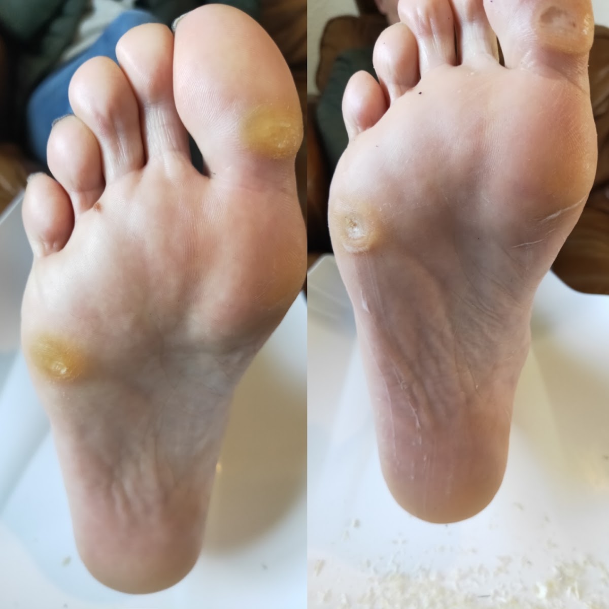 West Lakes Foot Care